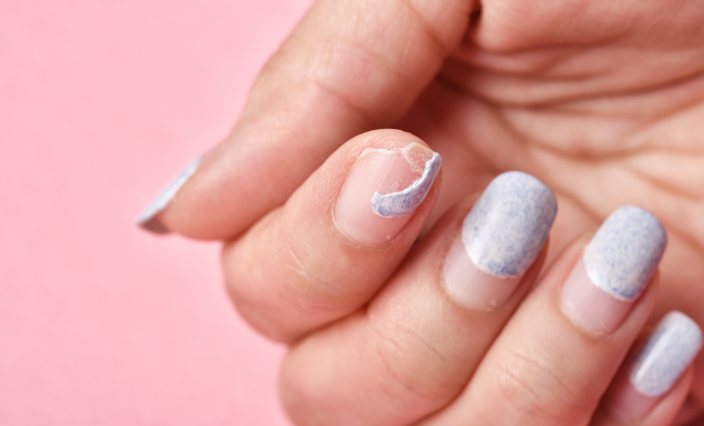 How to Treat a Broken Nail Under Acrylic?