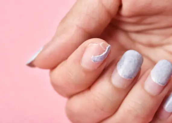 How to Treat a Broken Nail Under Acrylic?